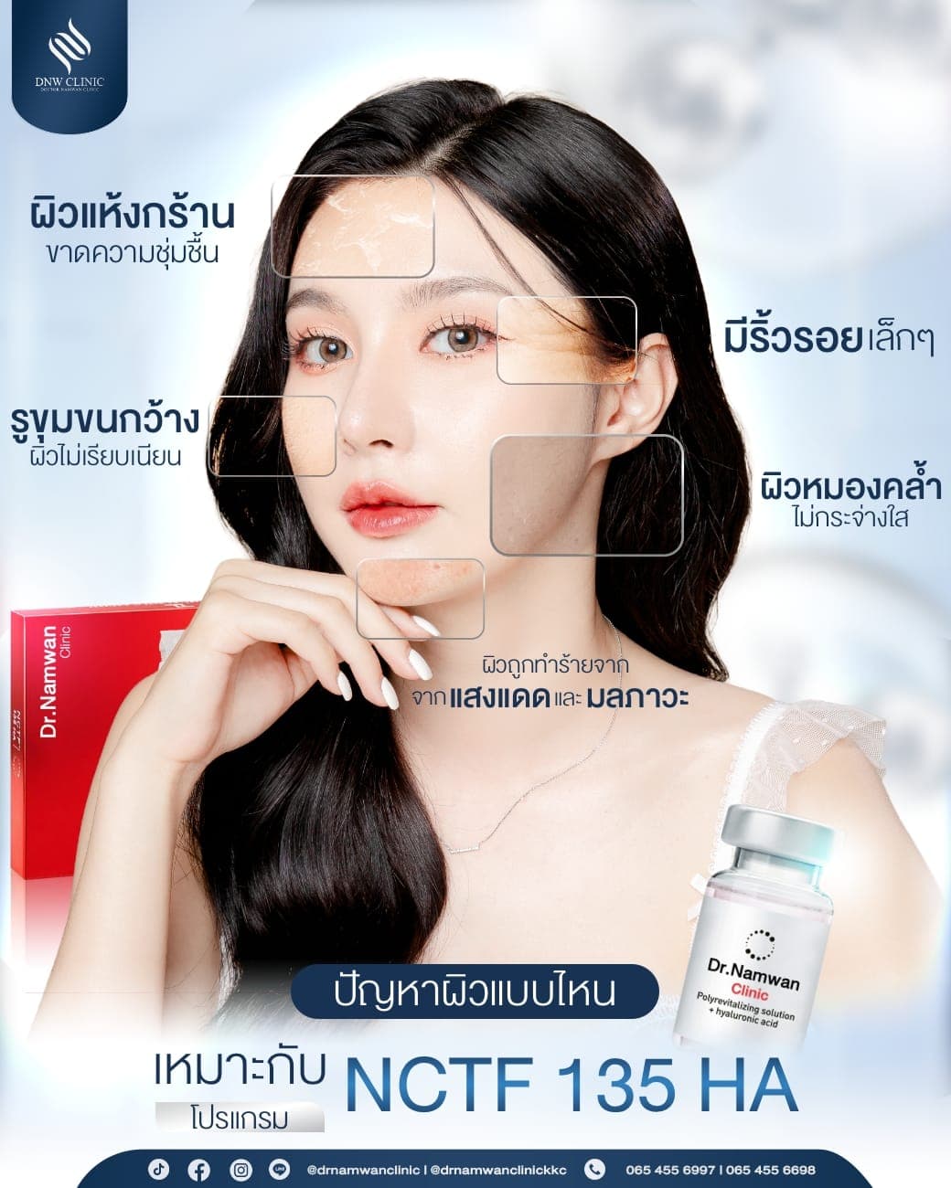 Fillmed NCTF 135 HA program (skin booster)