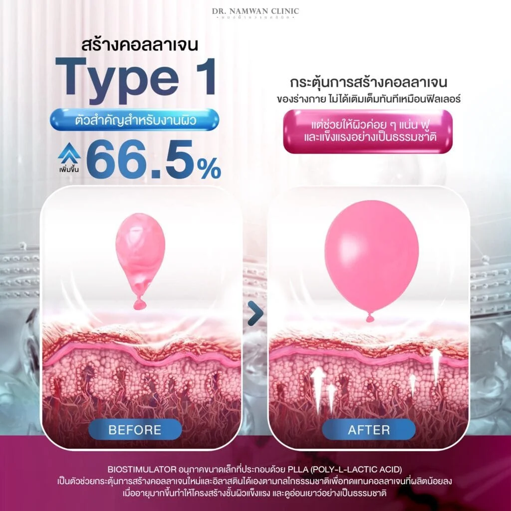 ภาพประกอบบทความ Sculptra Program คืออะไร? ต่างจาก Filler Program อย่างไร? และเหมาะกับใคร?